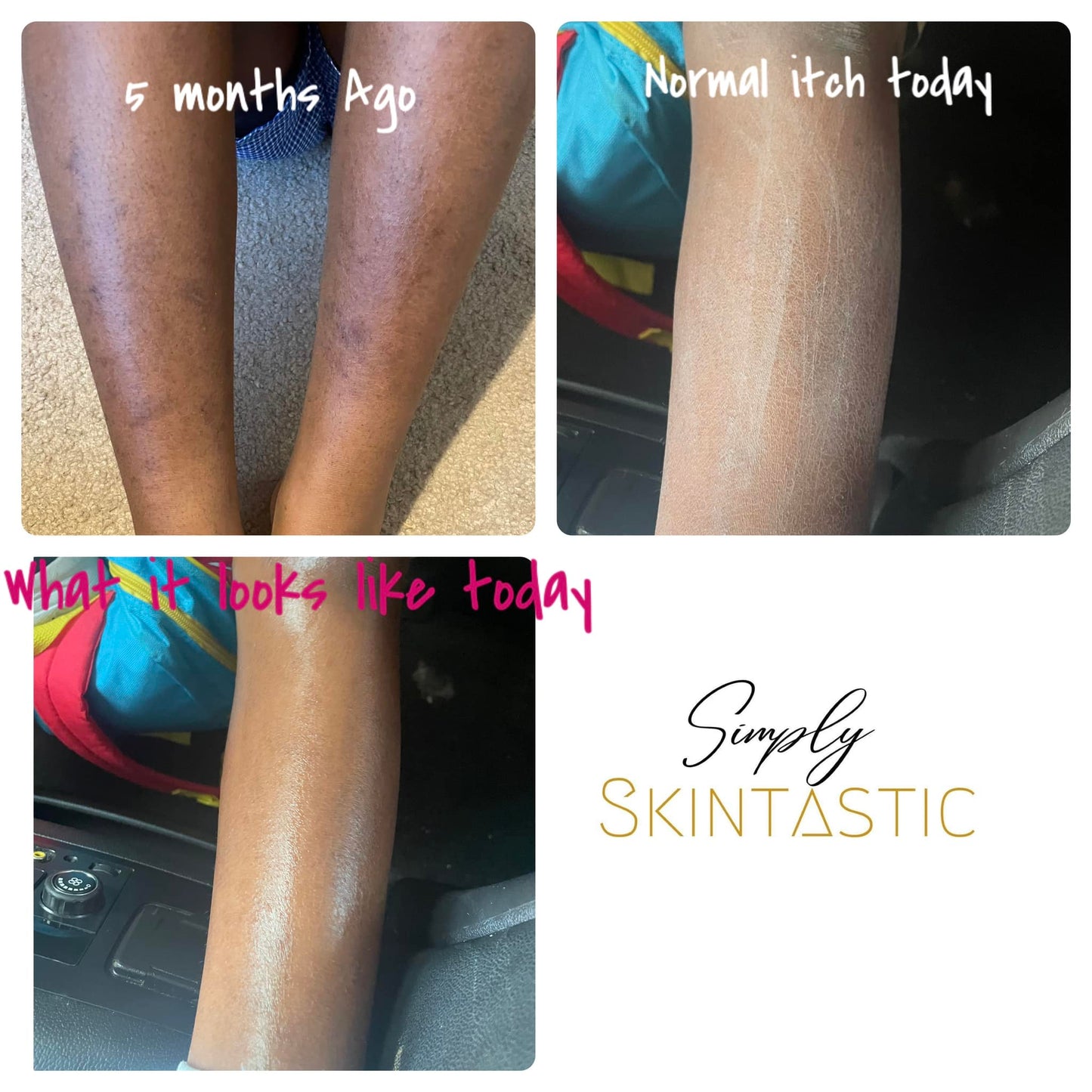 Skin Repair Butter - Simply Skintastic